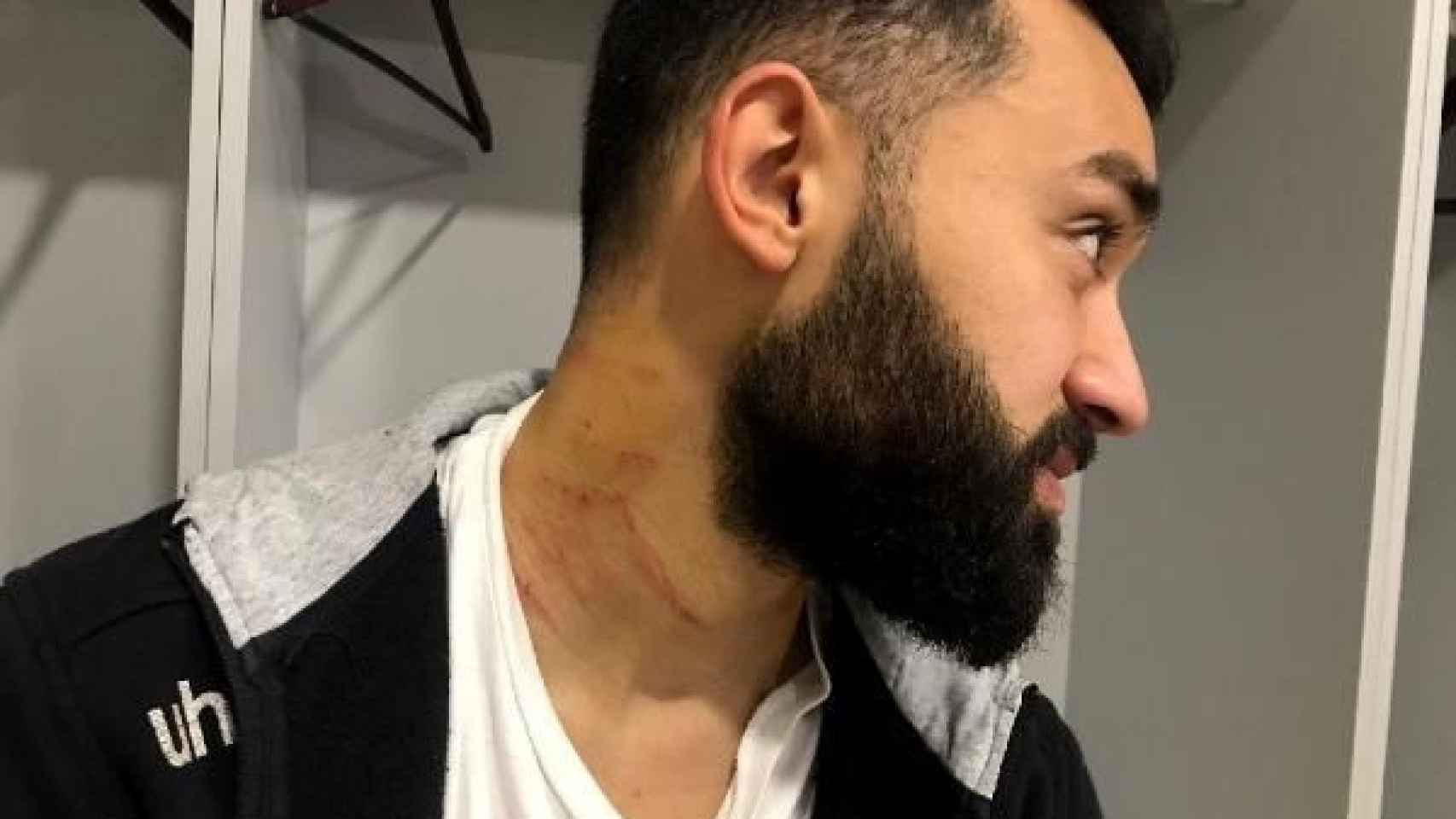 Las heridas en el cuello de un futbolista turco
