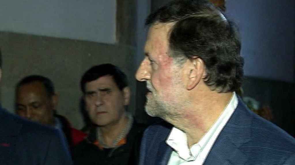 La cara magullada de Mariano Rajoy, tras ser golpeado en un paseo electoral en Pontevedra.