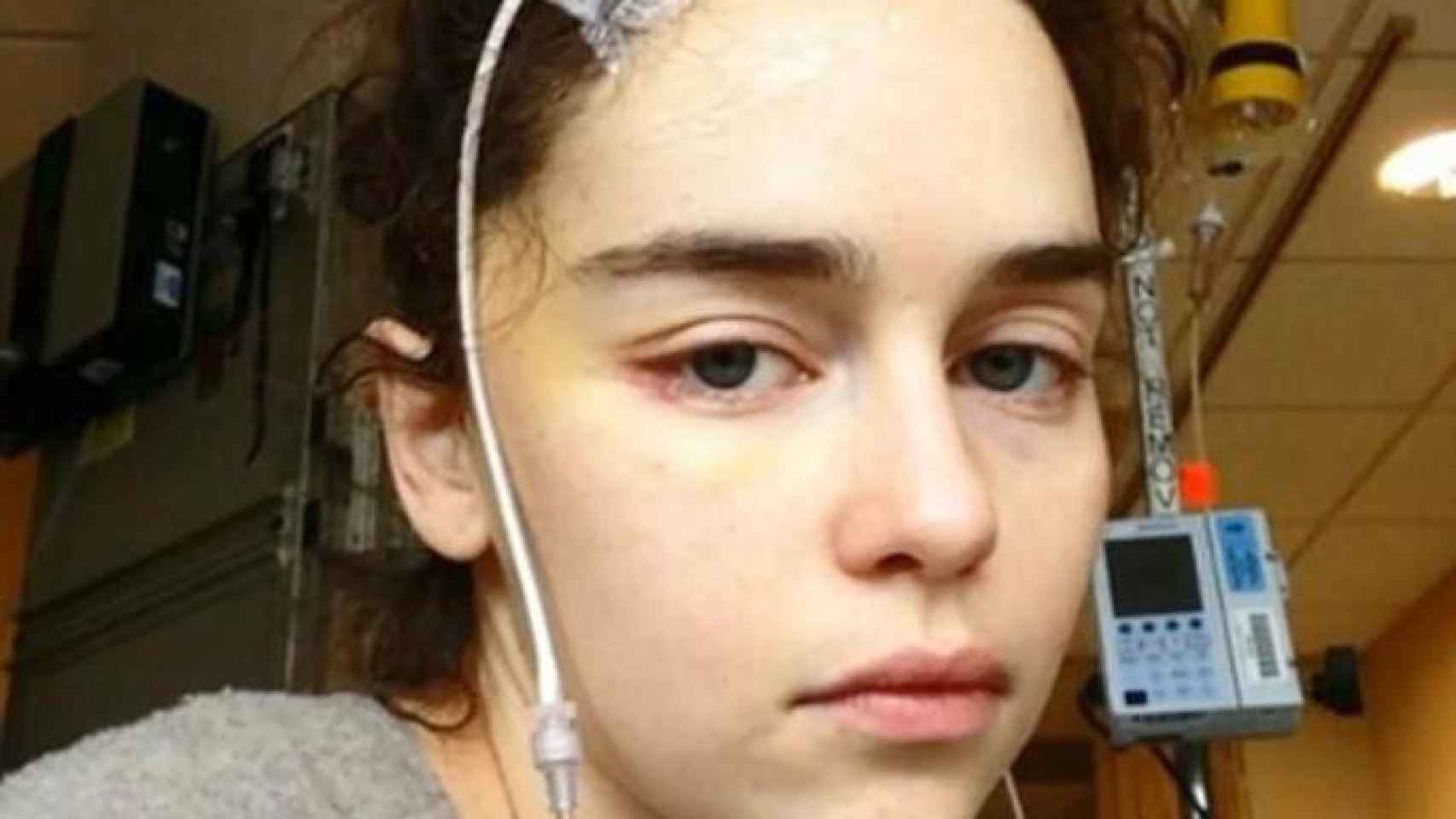 ‘Juego de Tronos’: Las chocantes imágenes de Emilia Clarke tras ser operada de un aneurisma.