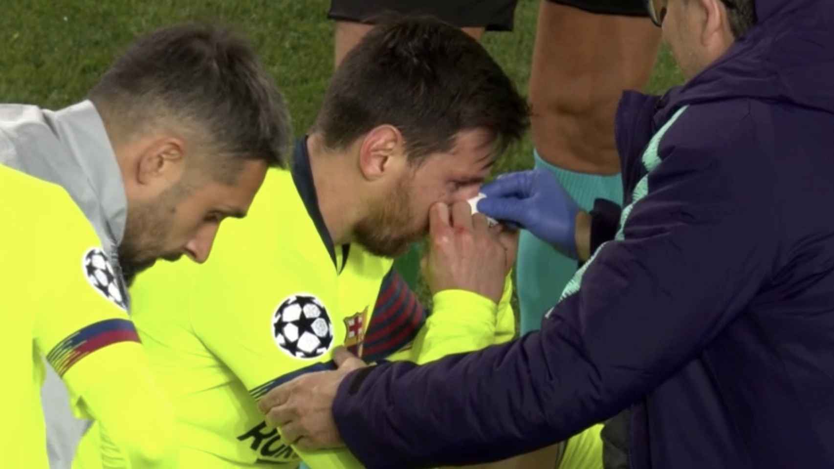 Messi recibe un duro golpe en la nariz