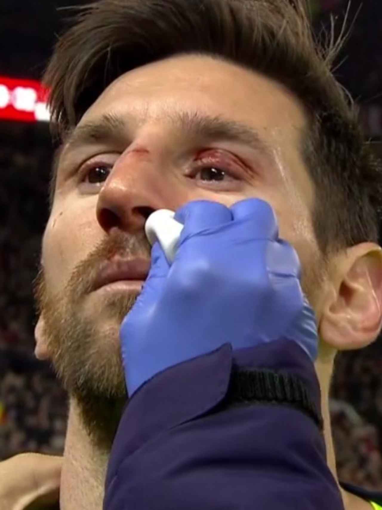 Messi, atendido por las asistencias médicas