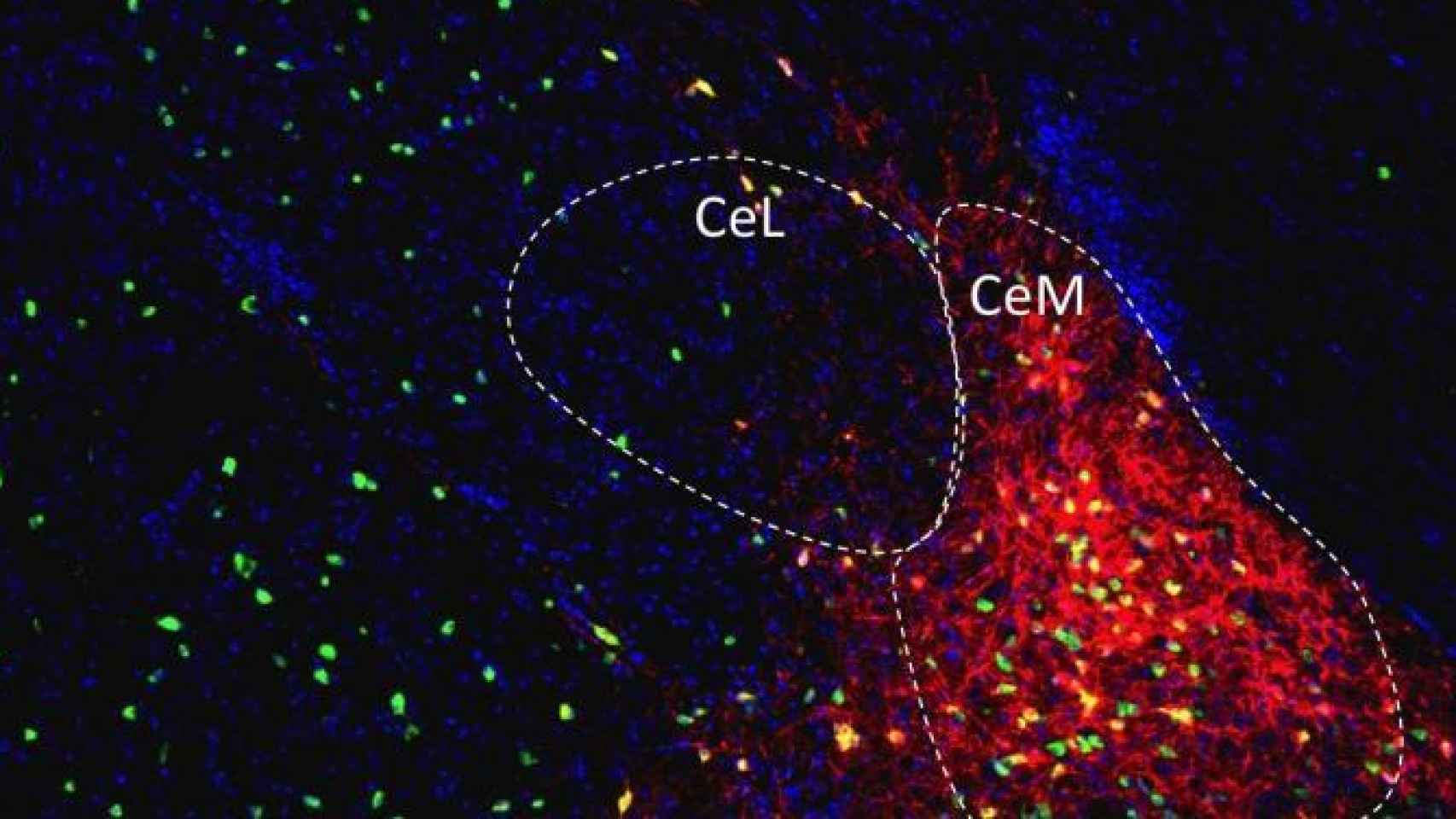 Imagen microscópica mediante fluorescencia de la amígdala (izqd) produciendo NPY (drch). Garvan Institute / Cell Metabolism