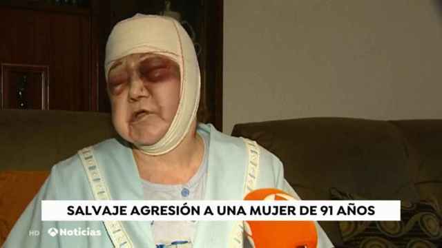 El agresor, de origen argelino, ha afirmado que no conocía a la víctima y que solo pretendía herirla. Foto: Antena 3.
