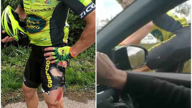 El ciclista español fue atropellado en Inglaterra.