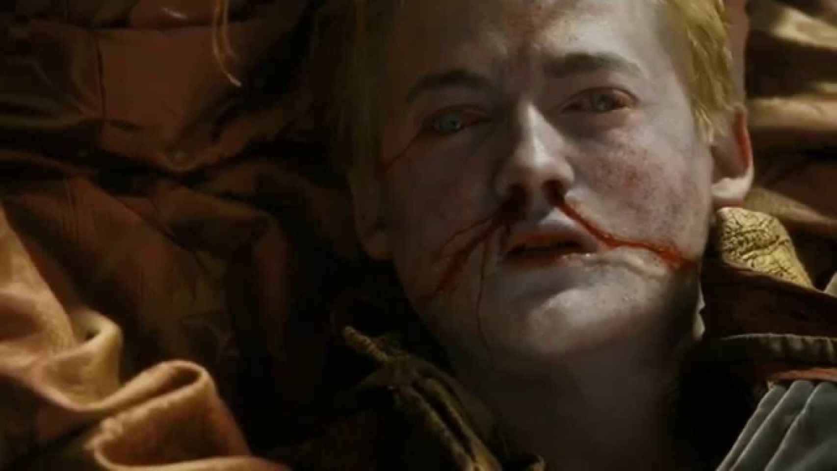 Joffrey en el momento de su muerte.