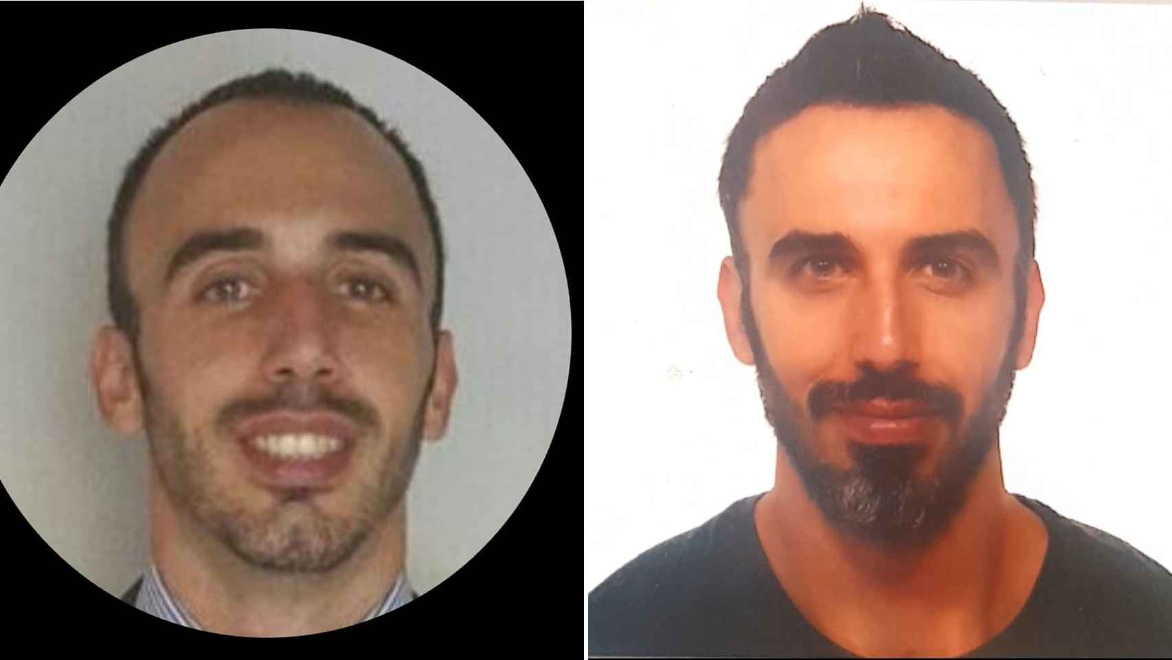 El antes y el después de Pablo, tras realizarse una operación de 12.000 euros.