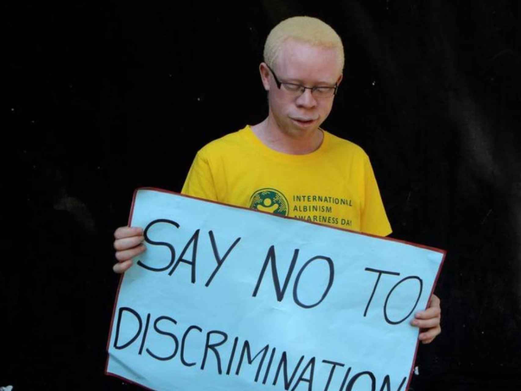 Un malauí albino sostiene un cartel en el que se lee: No discriminación