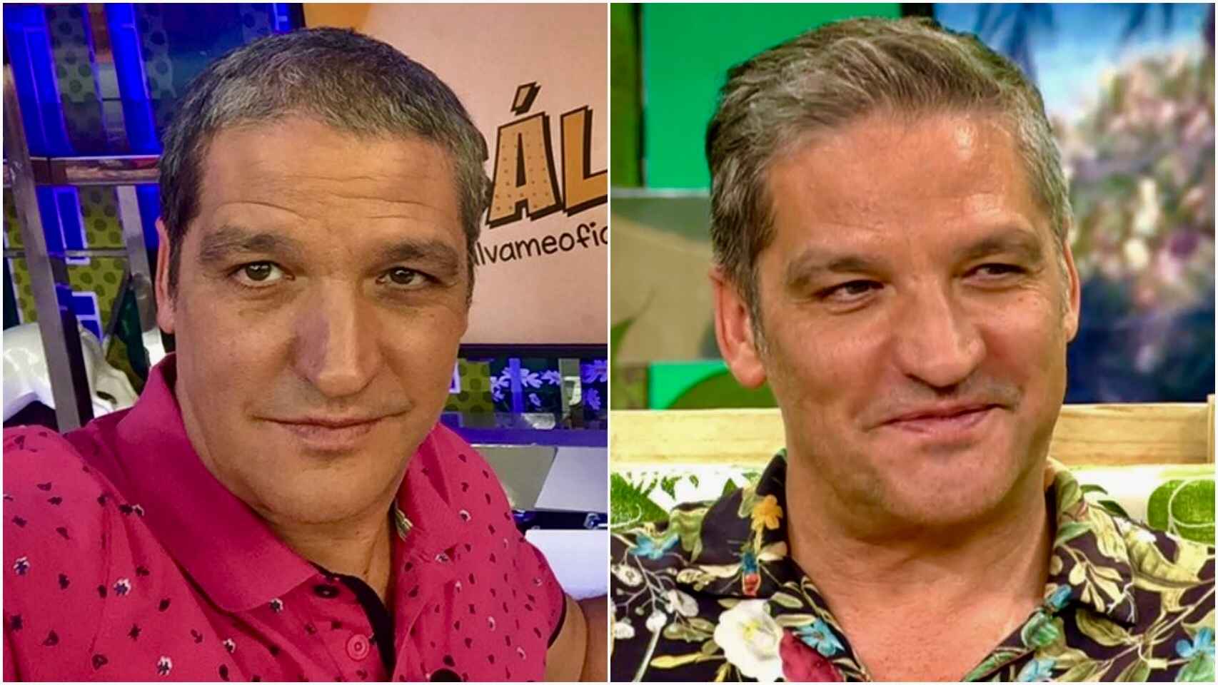 Gustavo González, antes y después de los retoques estéticos.
