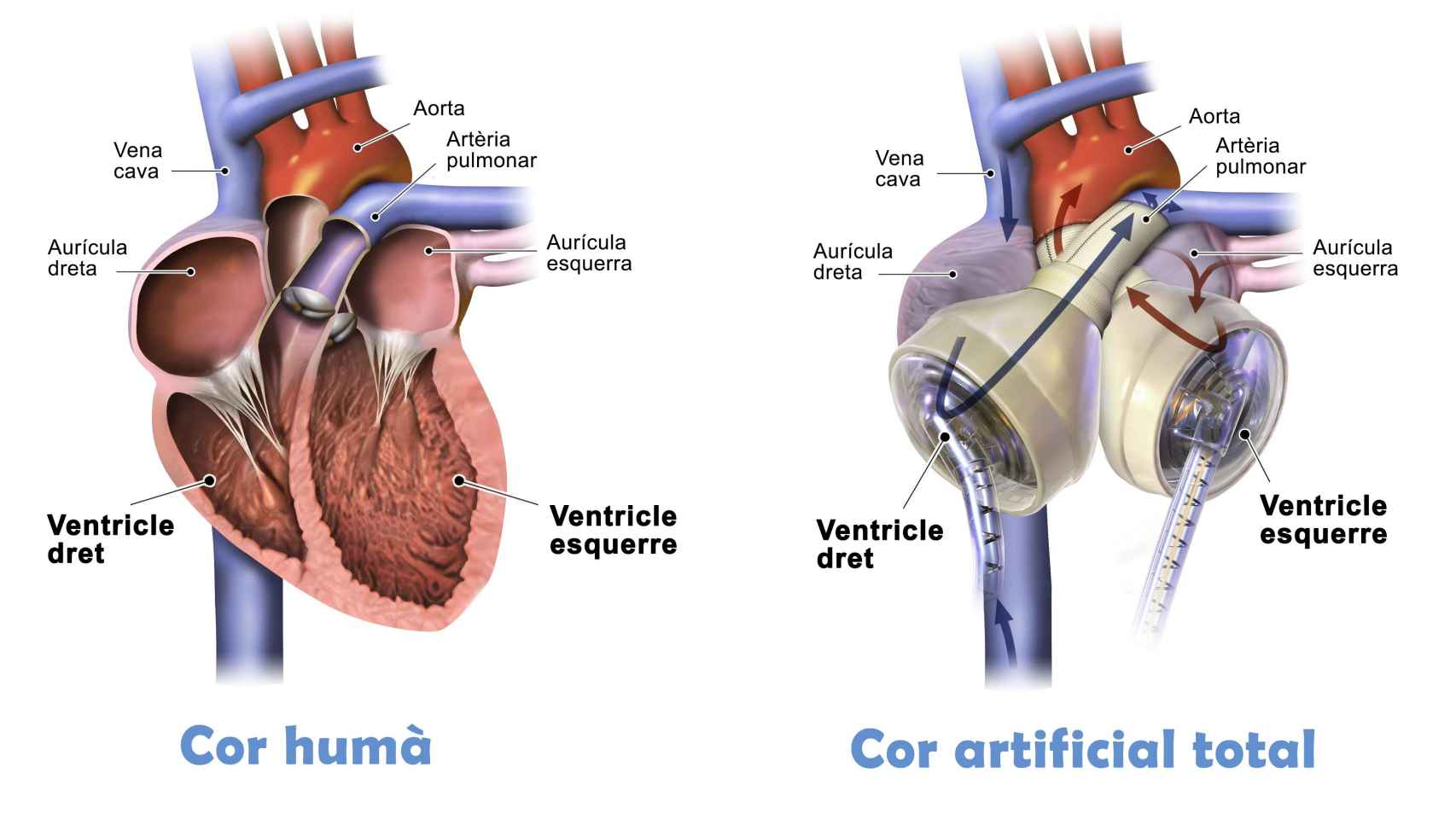 Gráfico del funcionamiento de un corazón normal y del artificial