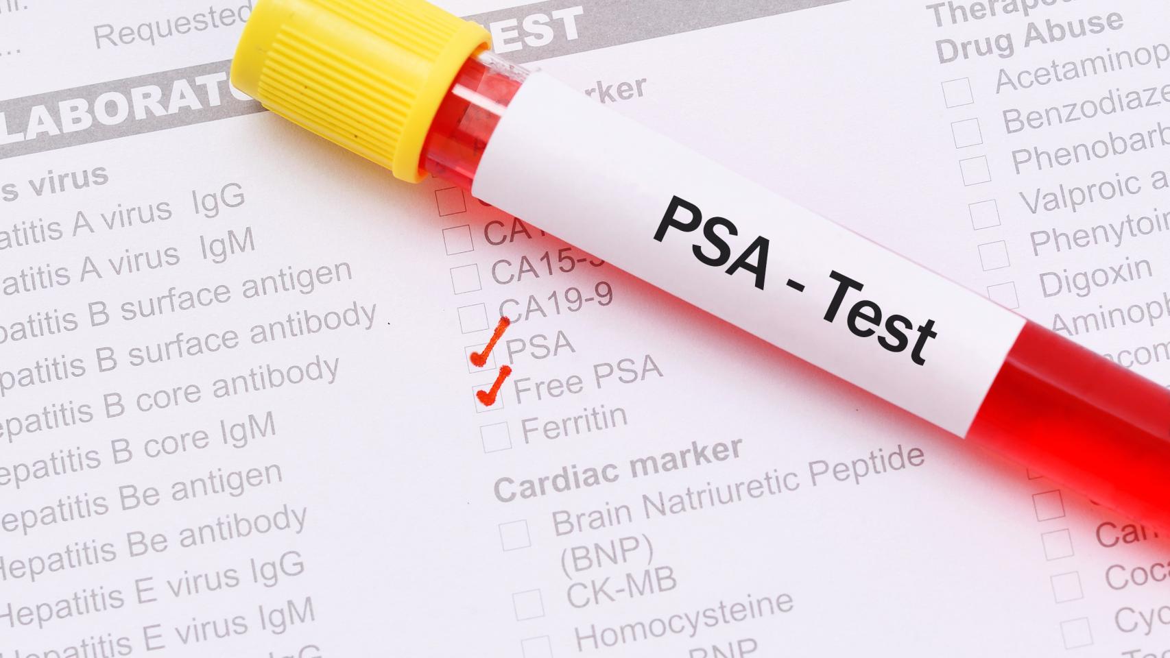 Analize Medicale - PSA (antigen specific prostatic) si free-PSA