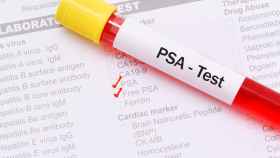 Test PSA - Harvard Health.