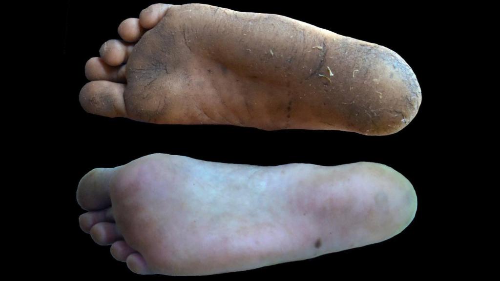 Los callos tienen un efecto beneficioso en los pies de los que caminan descalzos, ya que no comprometen la sensibilidad ni la marcha, mientras que el calzado puede reducir la capacidad de percibir estímulos. EFE/Nature.