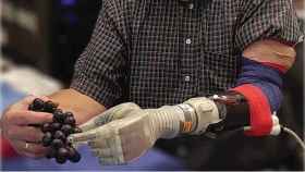 Crean brazos protésicos que devuelven el tacto a los pacientes
