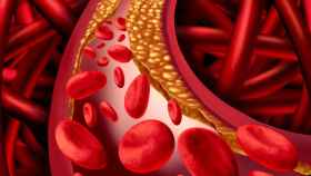 Representación de una arteria con colesterol adherido a las paredes.