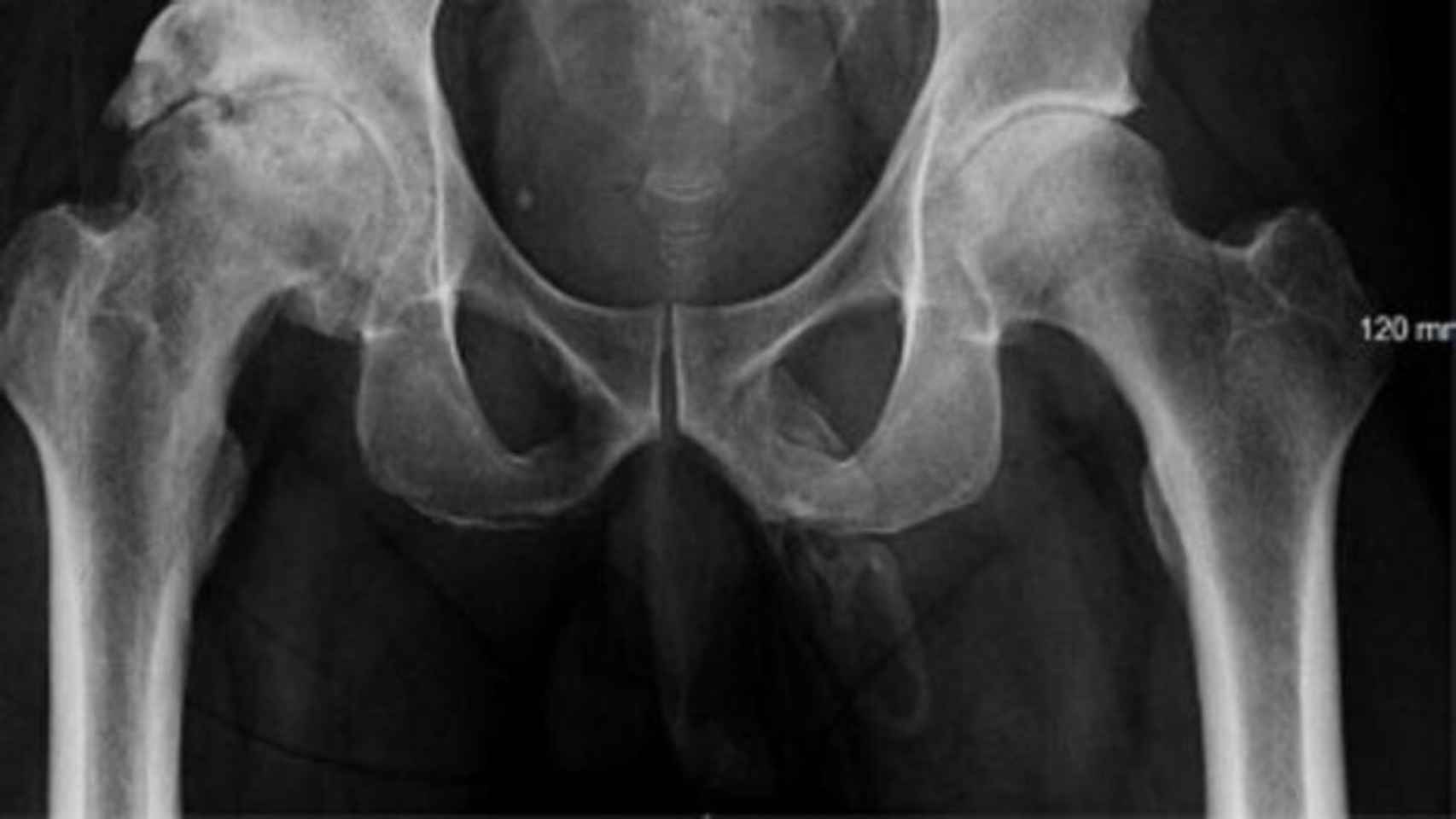 Radiografía en la que se aprecia la forma de un pene.
