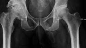 Radiografía en la que se aprecia la forma de un pene.