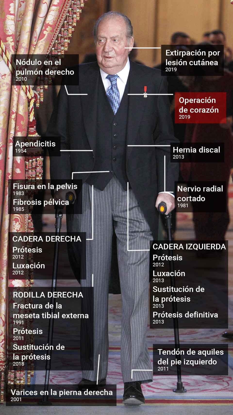 Todas las operaciones del rey Juan Carlos.