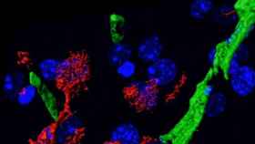 Las células del sistema inmune (rojo) salen de los vasos cerebrales (verde) para infiltrarse en el cerebro de ratones con alzhéimer. El tratamiento a largo plazo con dabigatrán disminuye este proceso y la patología asociada. / CNIC