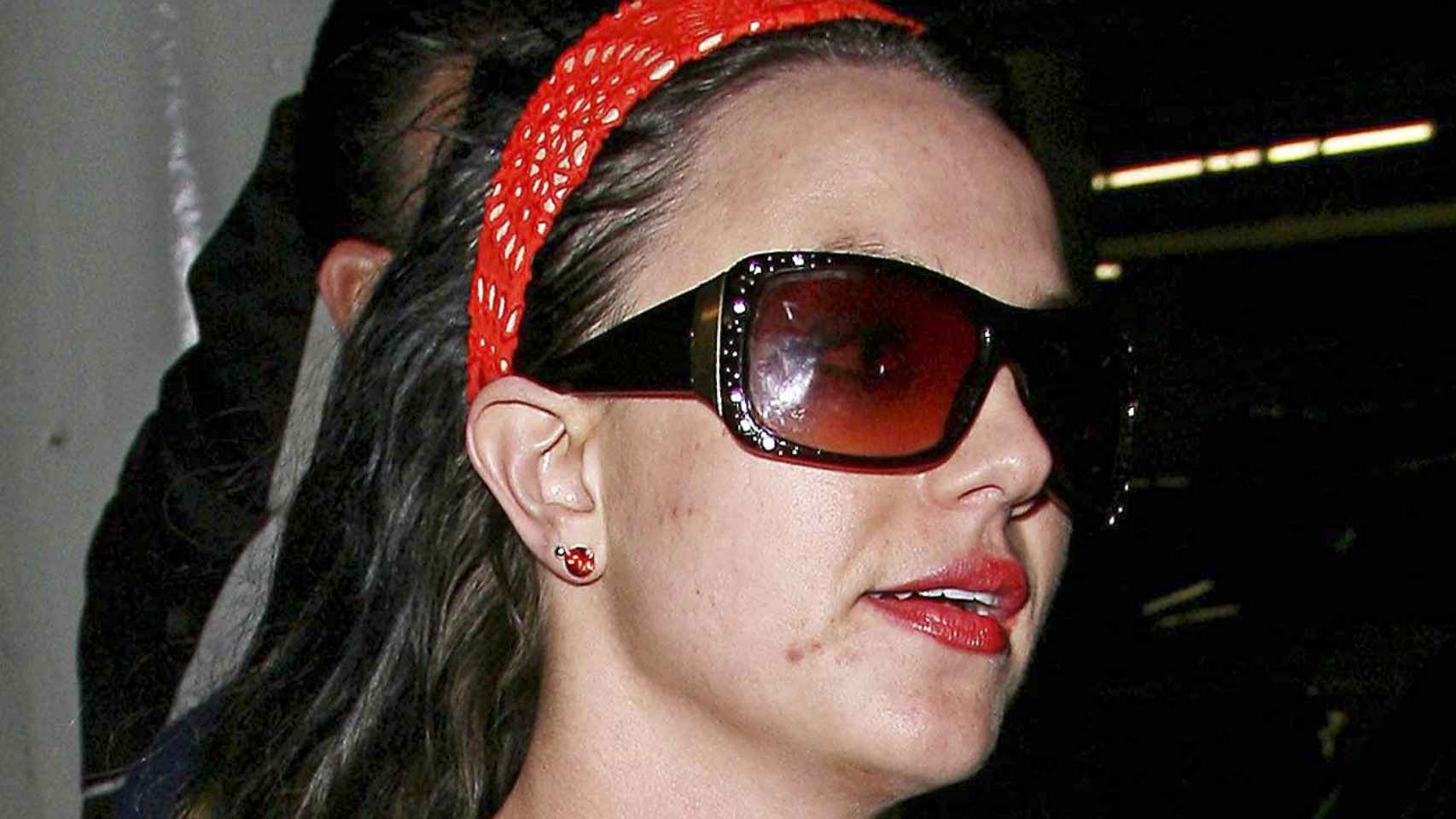Britney Spears es una de las celebridades que ha tenidos que luchar contra el acné en su carrera.