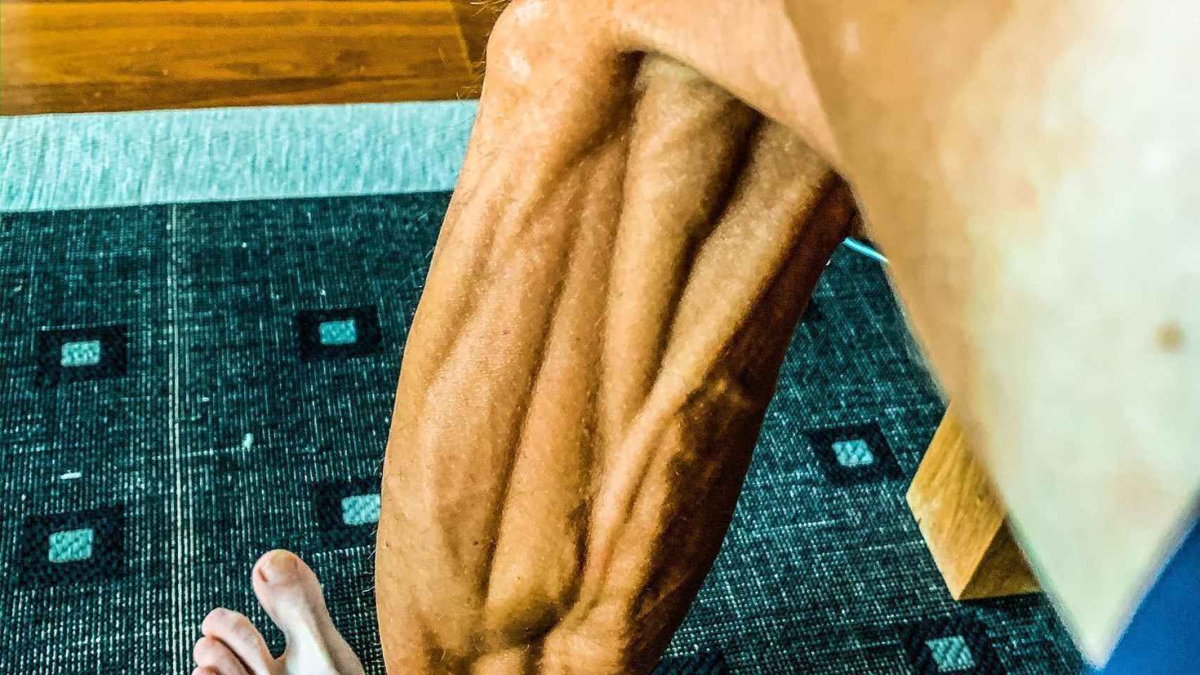 Así son las piernas de Brajkovic tras su sanción por dopaje