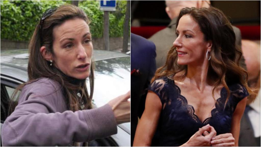 Telma Ortiz antes y después de sus retoques estéticos.