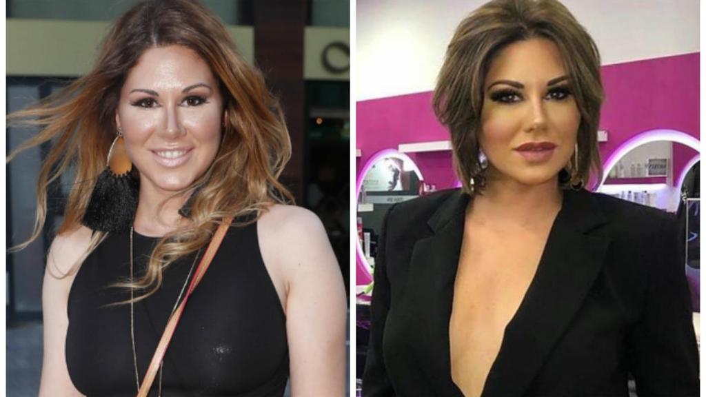 La cantante Tamara en montaje JALEOS junto a su antes y después.