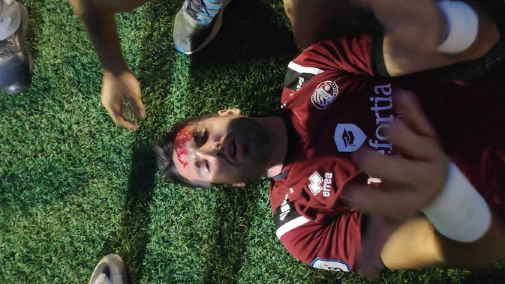 Héctor Pizana, portero  del Xerez Deportivo, tras sufrir la agresión