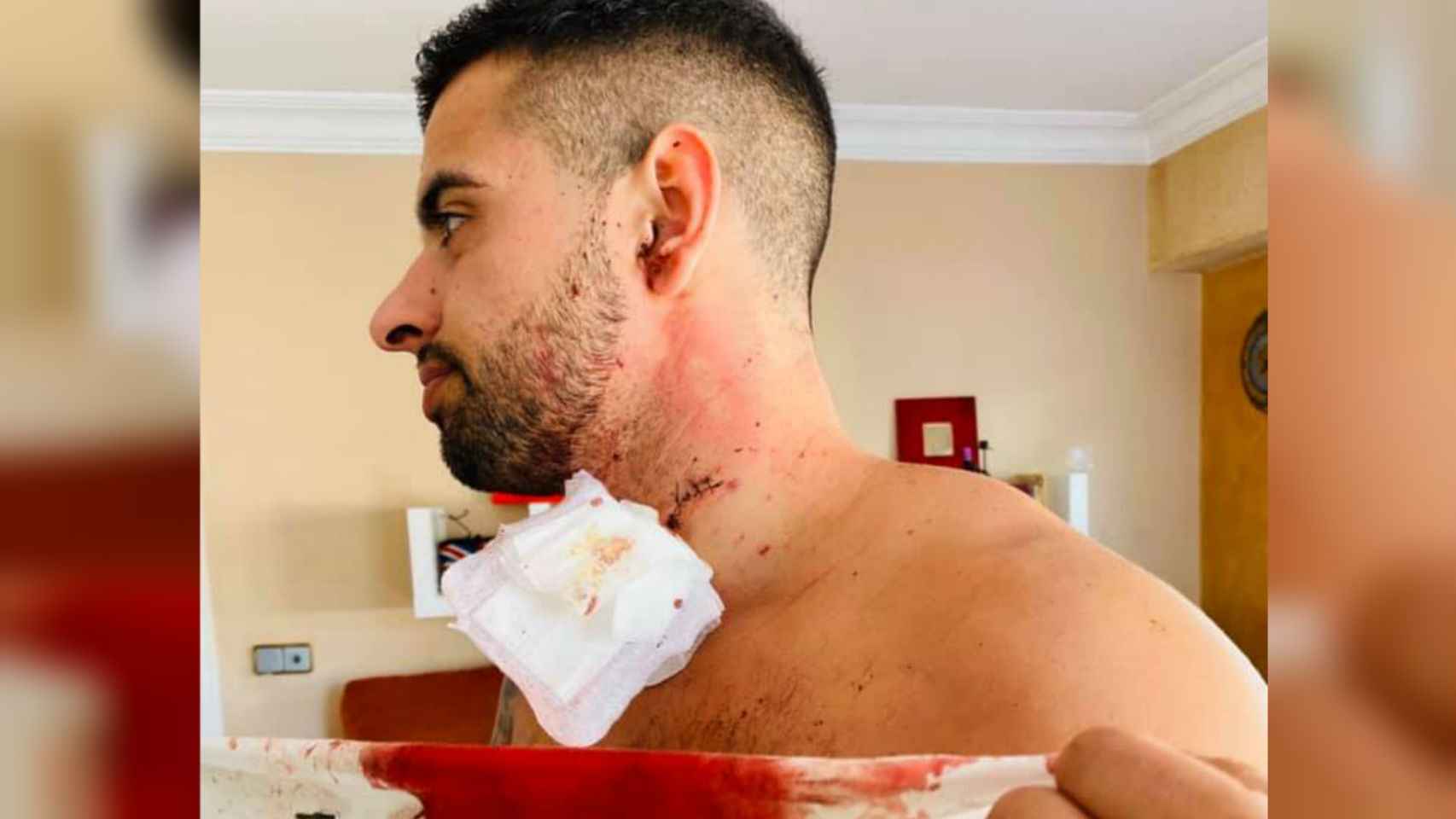 Juan Antonio muestra la herida en el cuello que le causó su agresor.
