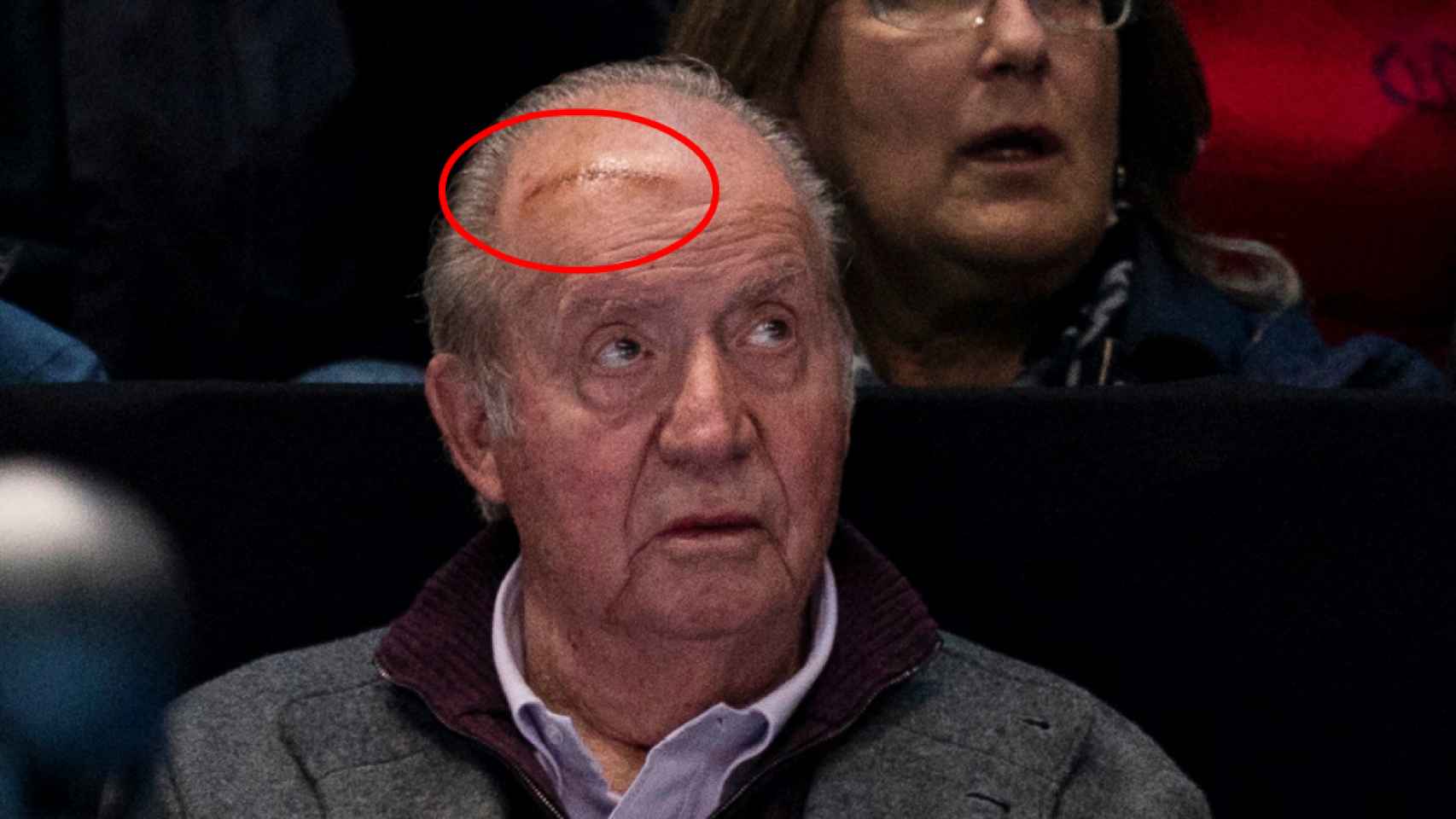 Detalle de la herida que luce Juan Carlos en la cabeza.