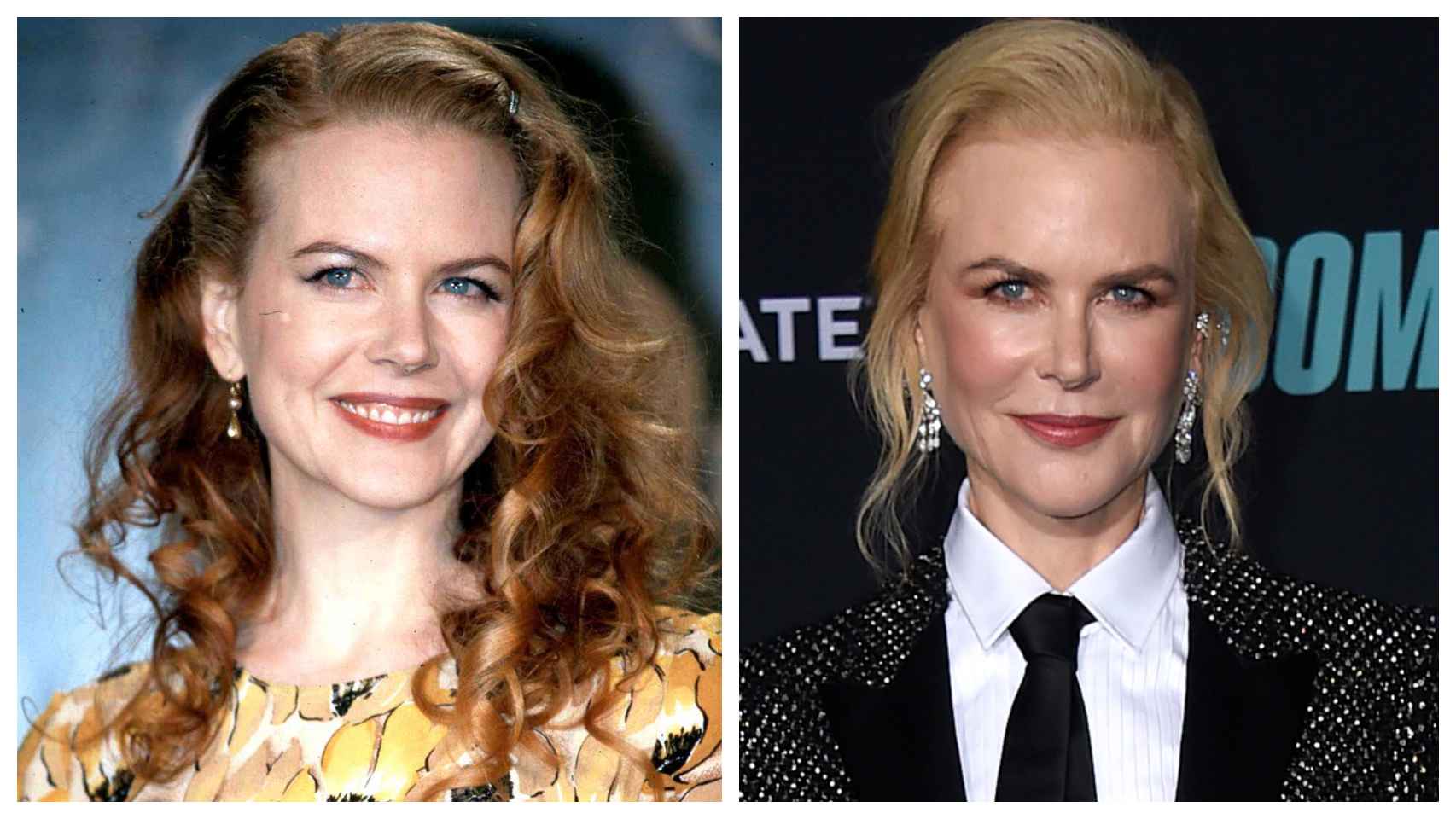 Nicole Kidman a comienzos del año 2.000 (izquierda) y en una imagen reciente (derecha).