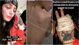Valeria Quer ha mostrado las heridas que le ha provocado su exnovio a través de las redes sociales.