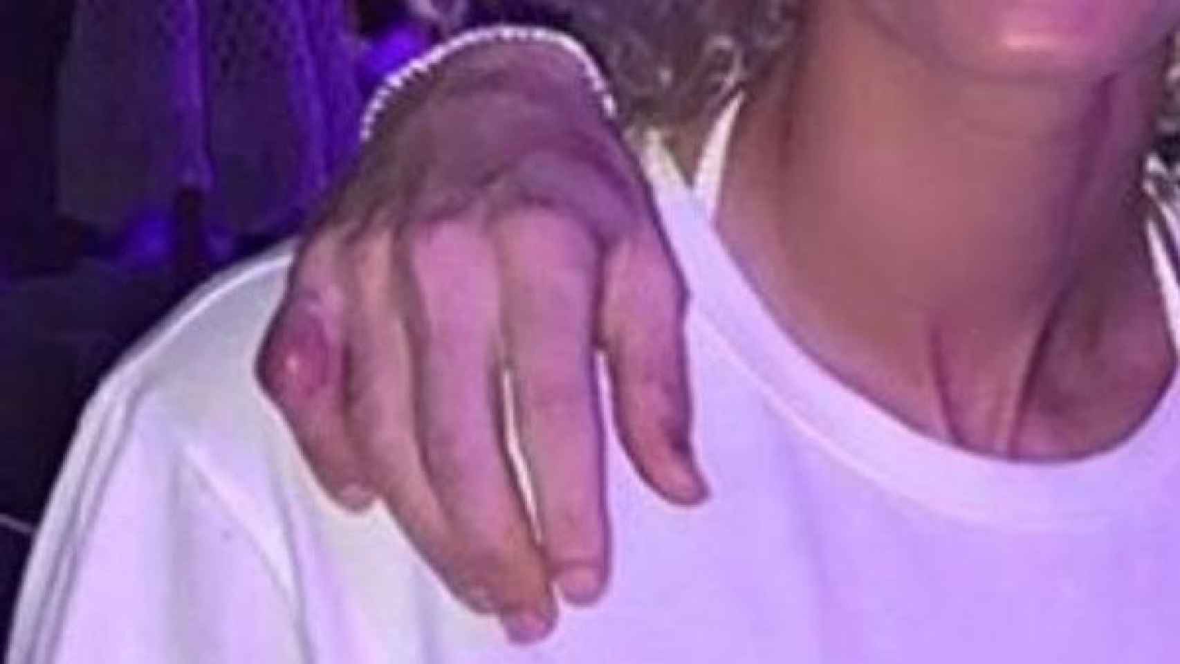 El dedo meñique de Benzema