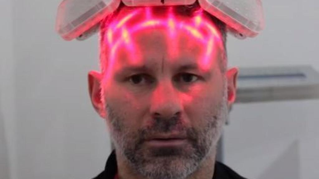 Ryan Giggs, durante el tratamiento capilar