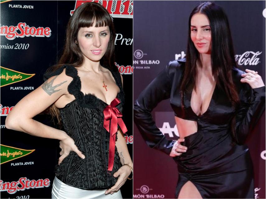 María Rodríguez 'La Mala' antes y después de sus retoques.