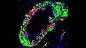 Análisis por inmunofluorescencia de las células musculares del ovario. Guang-Hui Liu.