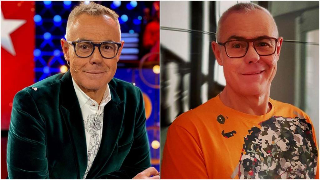 Jordi González, antes y después de su retoque estético.