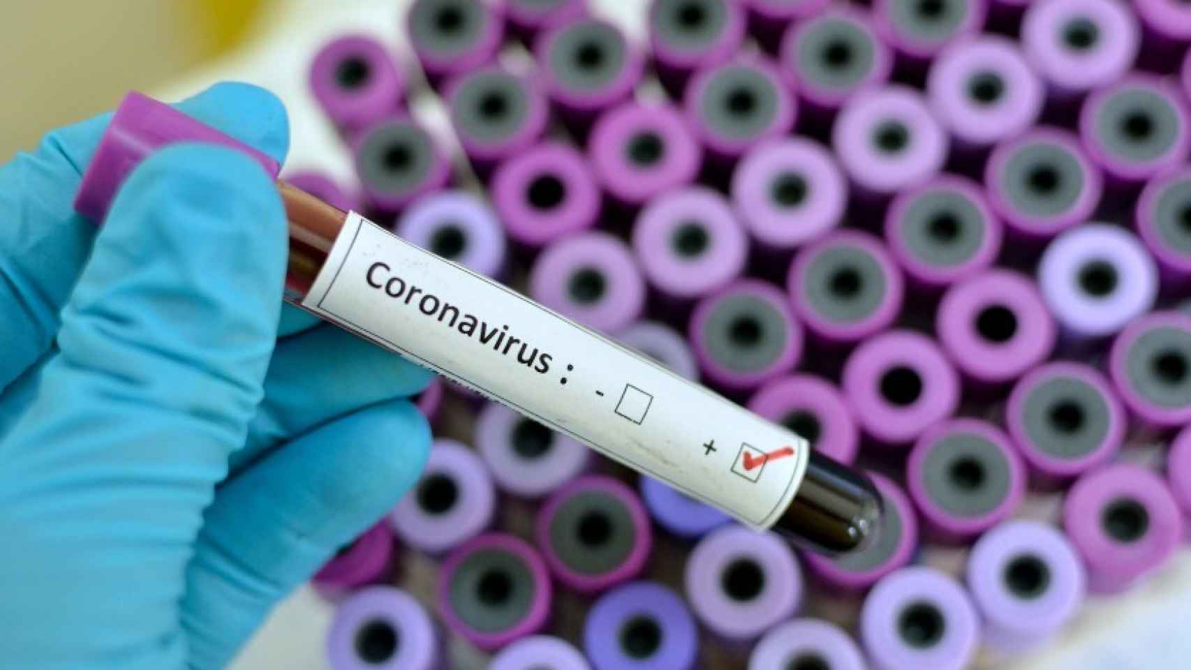Las compañías buscan a contrarreloj un tratamiento contra el coronavirus.