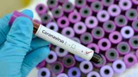 Antirretrovirales contra el coronavirus. EP