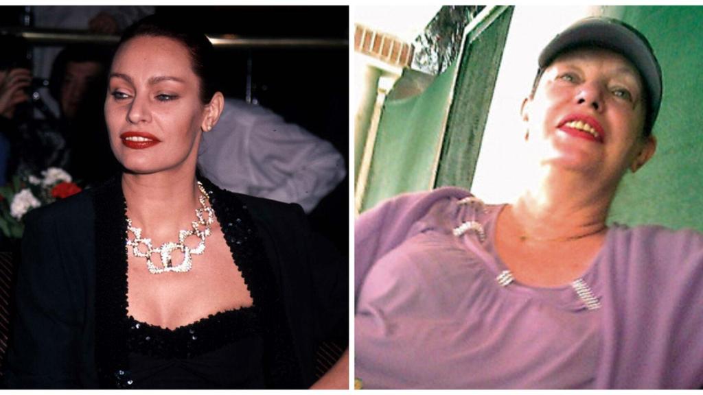 Nadiuska en un montaje de JALEOS con dos imágenes comparativas de su antes y después.