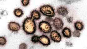 SARS-CoV-2, conocido simplemente como coronavirus