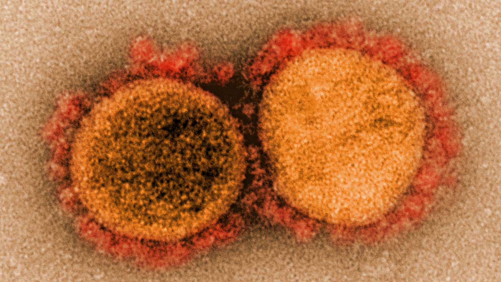 El coronavirus SARS-CoV-2
