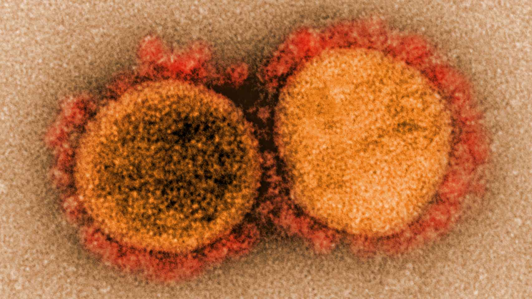 El coronavirus SARS-CoV-2.