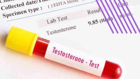 Testosterona.