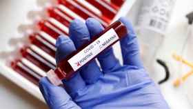 Test de detección en sangre del nuevo coronavirus.
