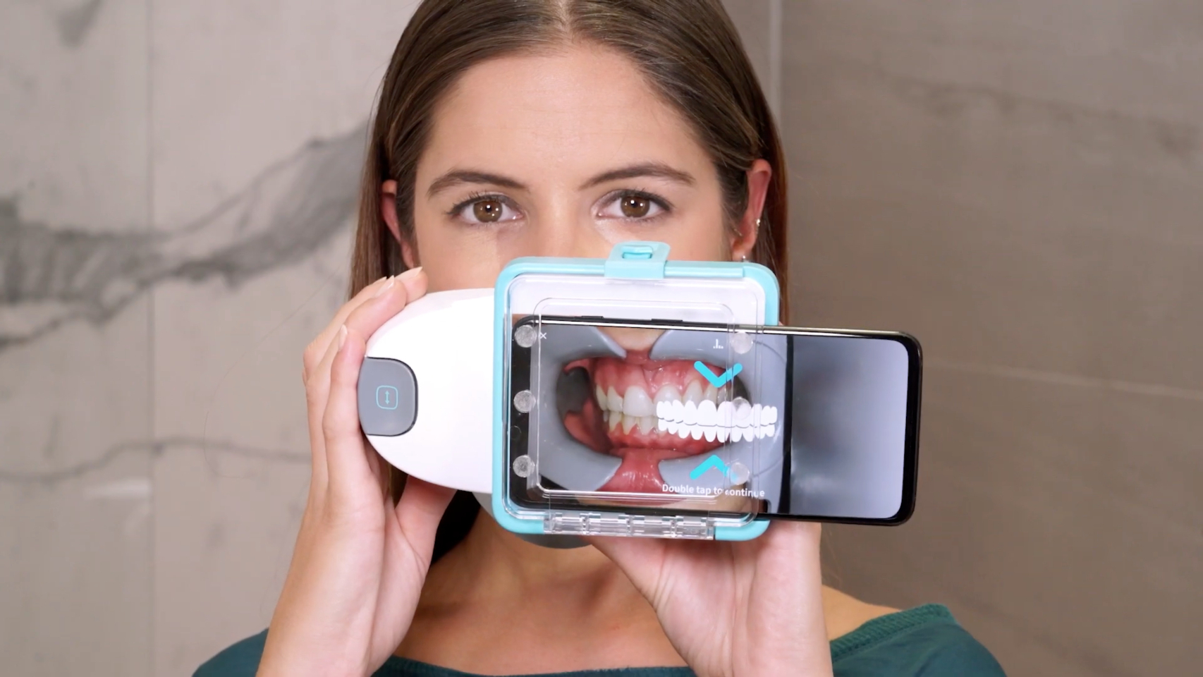 Este escáner permite que tu dentista revise desde casa