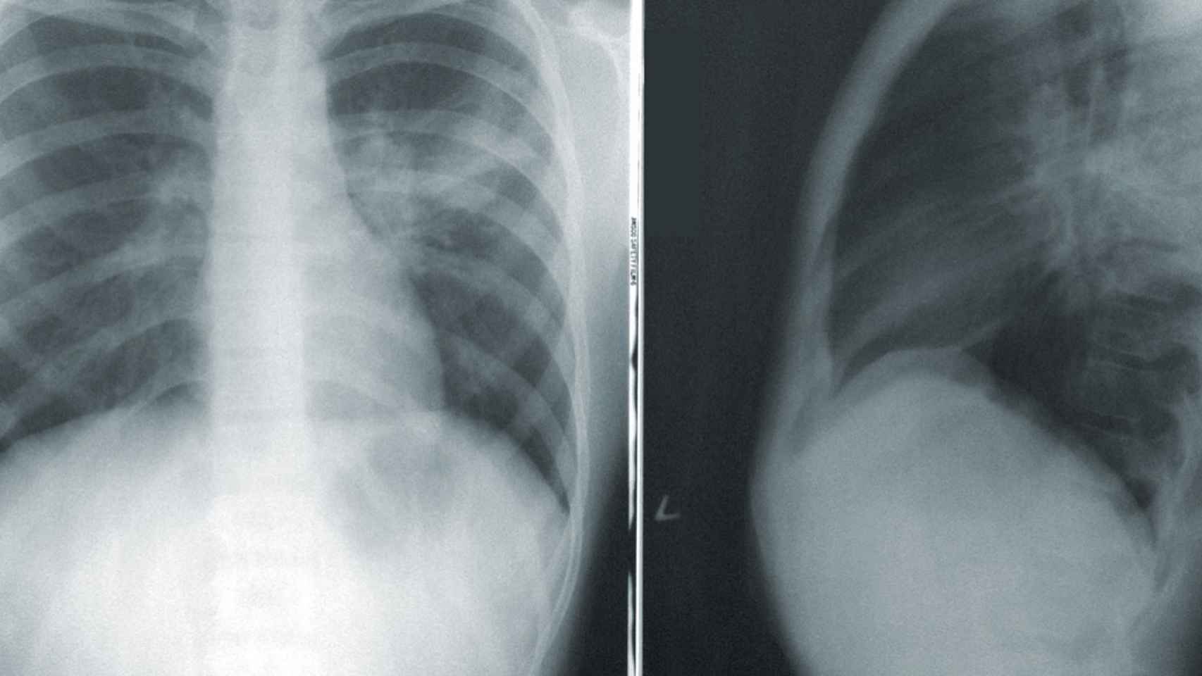 Imagen tradicional de rayos X.