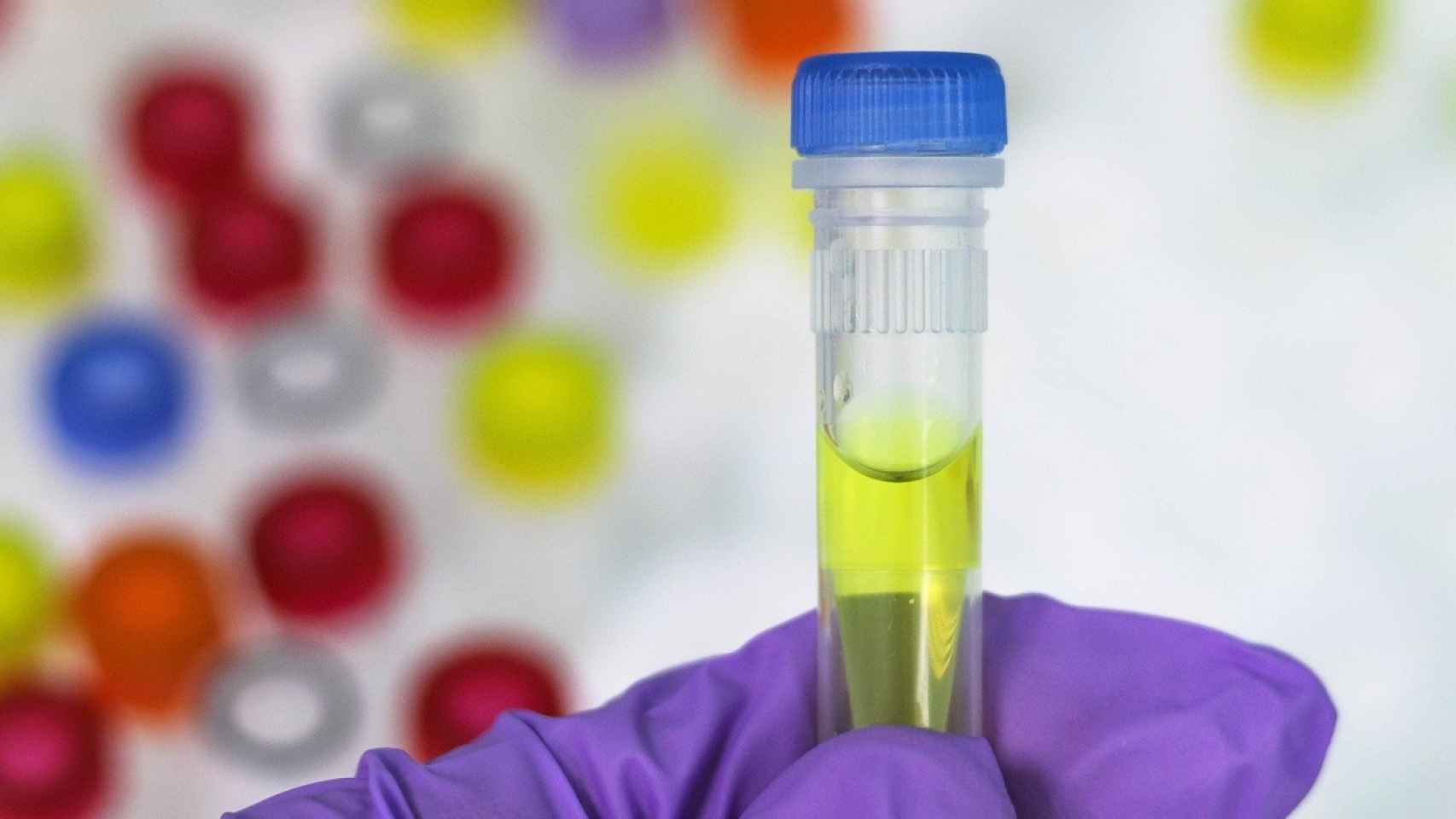 Los laboratorios de tests PCR, tras la intervención pública: burocracia incompleta que cuesta vidas