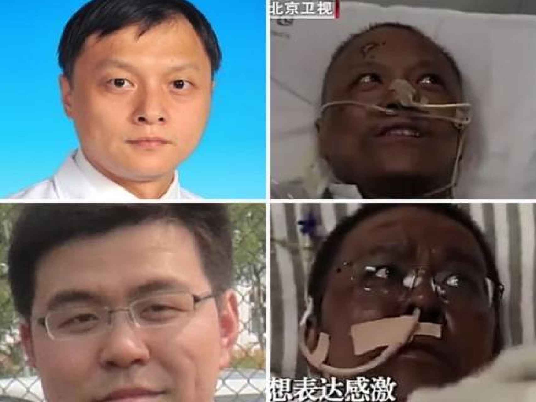 Arriba el doctor Yi Fan, y abajo el doctor Hu Weifeng, antes y después del tratamiento.