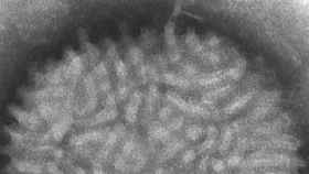 Imagen al microscopio del virus Vaccinia.
