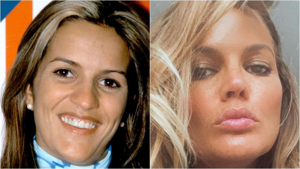Retoque de labios y pómulos.